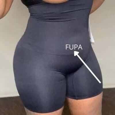 How to get rid of FUPA: Exercises, dietary tips, and more